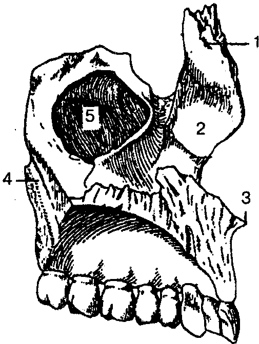Клыковая ямка. Верхнечелюстная кость анатомия. Левая верхняя челюсть анатомия. Клыковая ямка верхней челюсти. Альвеолярный и небный отросток верхней челюсти.